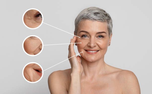 An image where you can see different close-ups of the most important areas to address during a facial rejuvenation process.