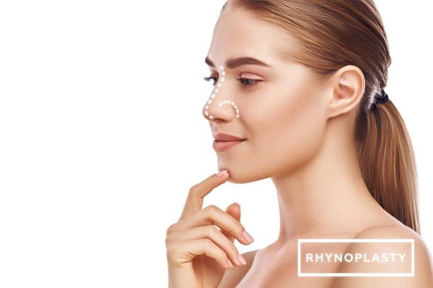 Photo where you can see the side of a woman's face with the marked silhouette obtained thanks to a rhinoplasty superimposed.
